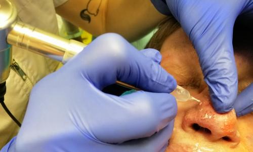 Majel B.V. | Dermatografie